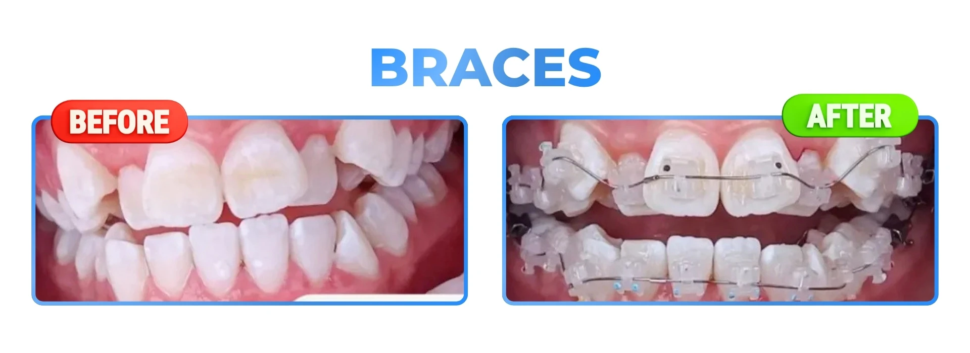 DAVEN DENTAL (5) (1)
