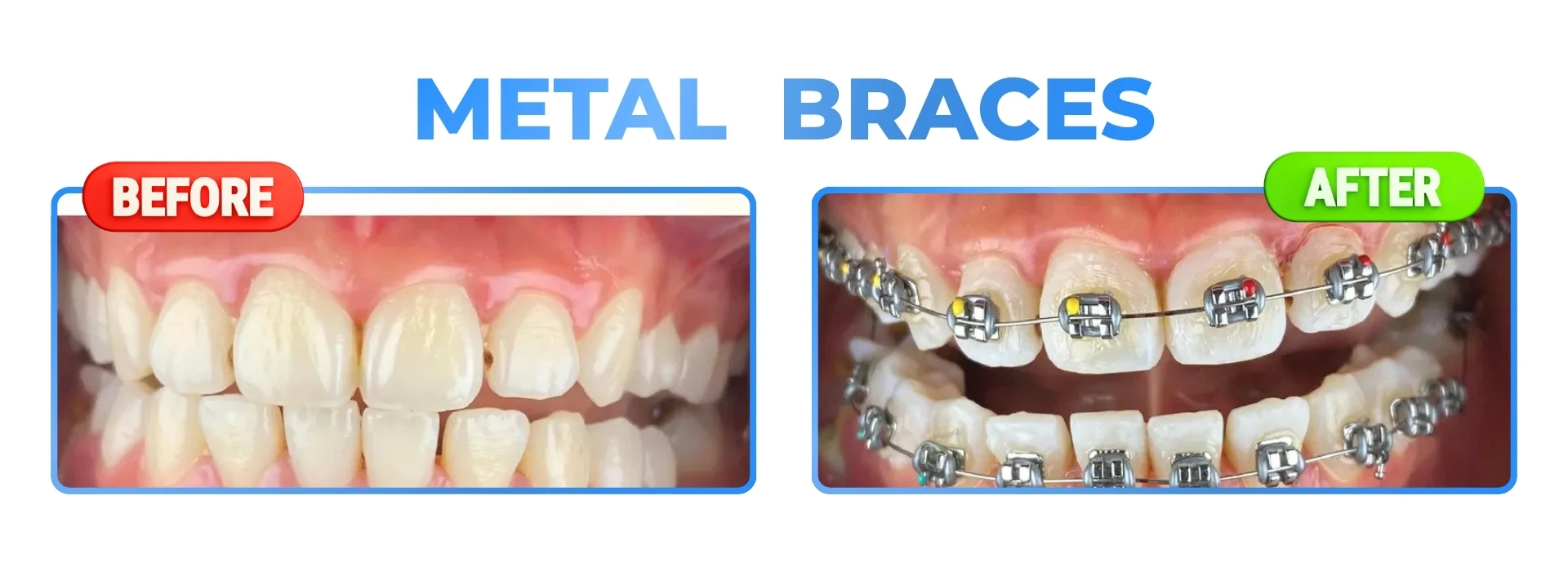 DAVEN DENTAL (7)
