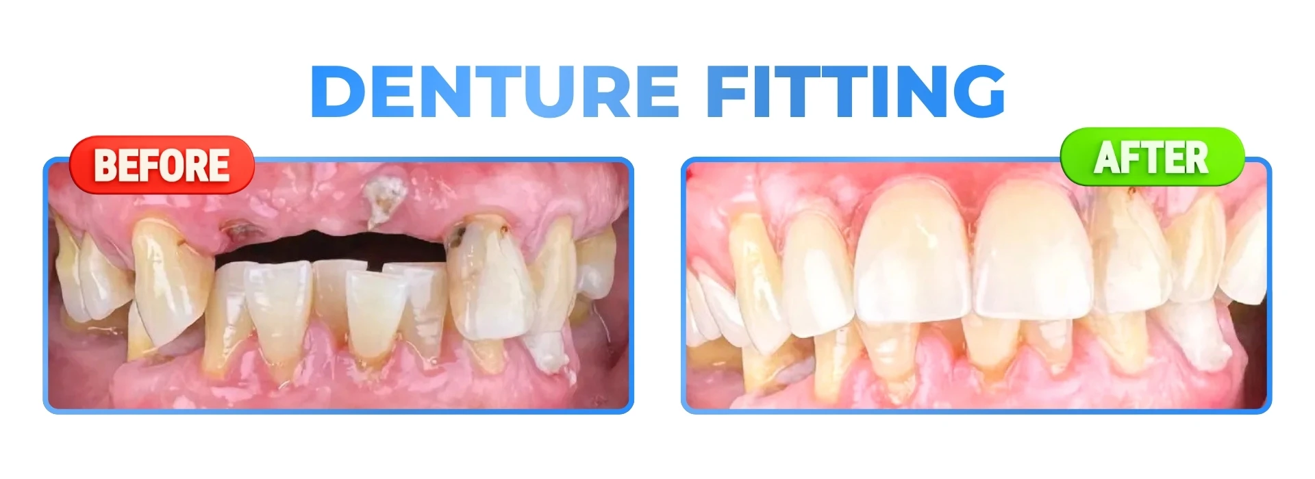 DAVEN DENTAL (8)