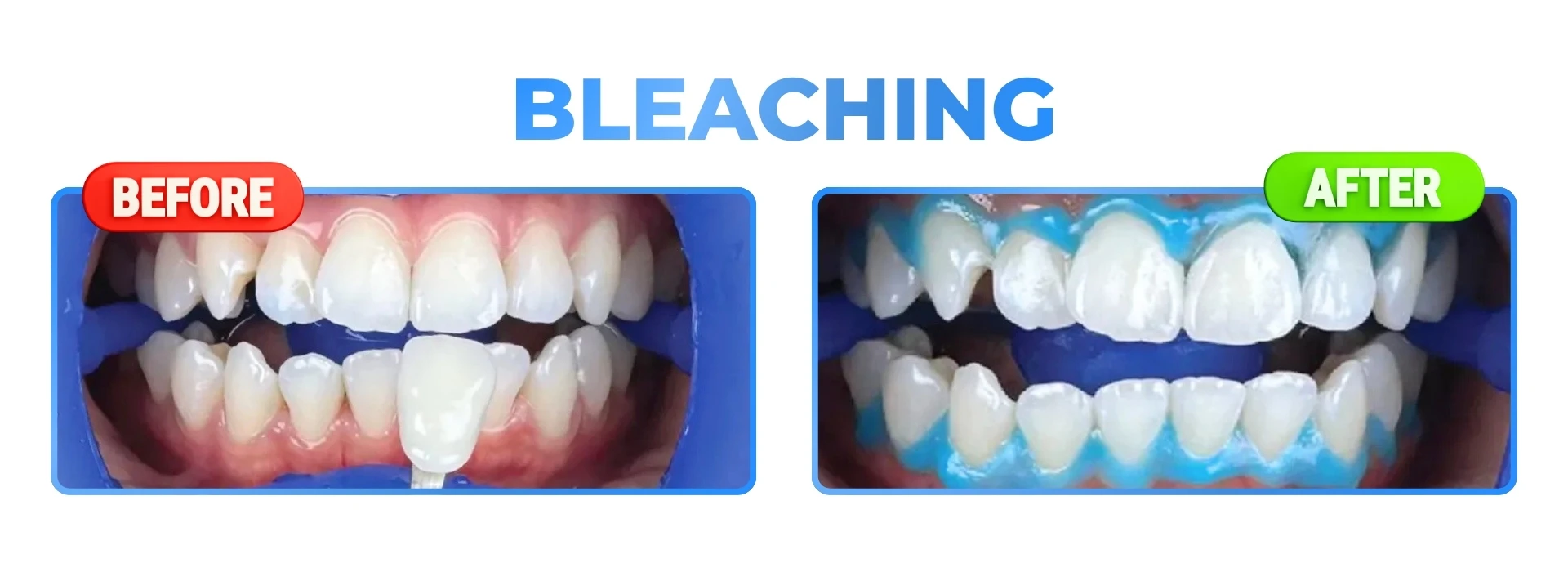 DAVEN DENTAL (9)